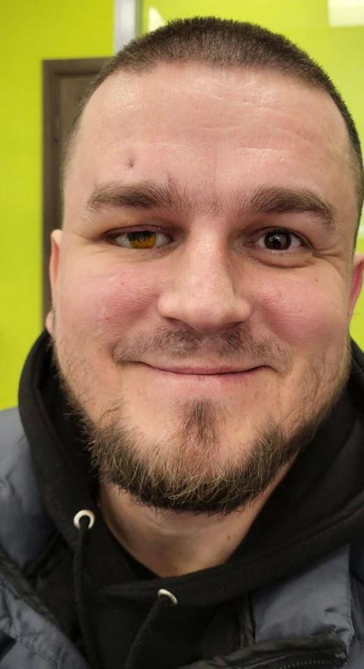 Генерали батальйону посмішок: майстерня, де ветеранам створюють обличчя 11