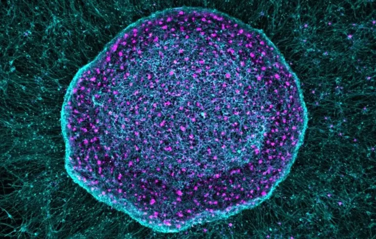 Губка для болю - що це таке - що придумали вчені, і як вона працює 1