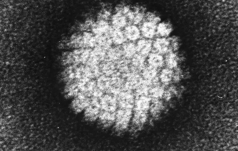 Коли з'явився вірус папіломи людини - ВПЛ знайшли у крижаної людини Етці та людини з Усть-Ішима 1