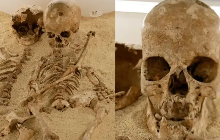 В Італії знайшли кістки дівчинки кам'яної доби з незвичайною хворобою - що виявили вчені - фото 1