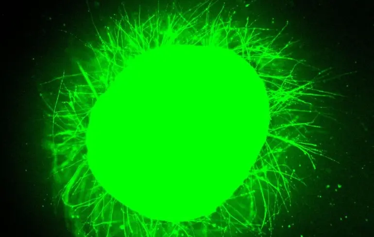 Чи можливо вилікувати спинний мозок - науковці протестували новий підхід на органах, отриманих у лабораторії. 1