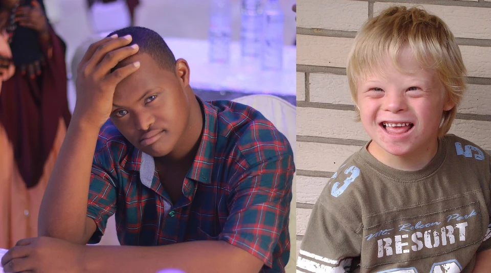 Всесвітній день людей із синдромом Дауна: історія, факти та особливості. 3