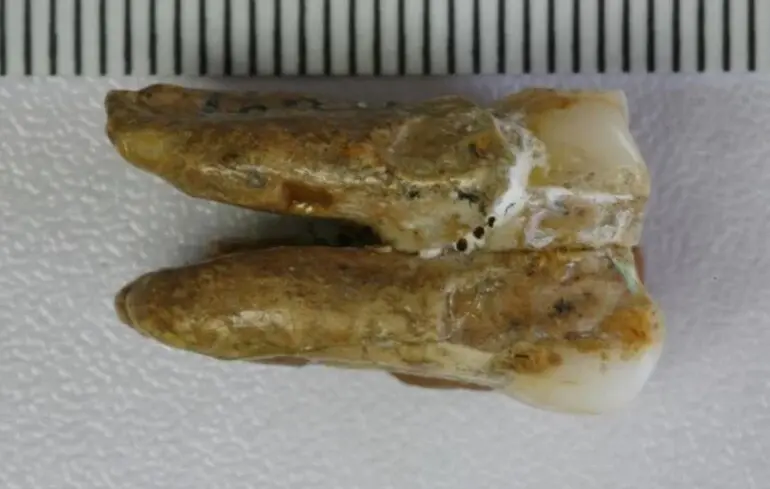 Дослідники виявили ознаки схрещування між денисівцями та Homo erectus, що має велике значення для розуміння еволюції людини. 1